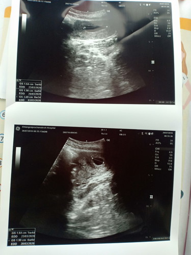 ใครเป็นเหมือนกันบ้าง9w