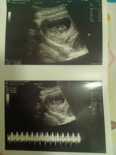 ซาวครั้ง3เจอน้องแล้ว