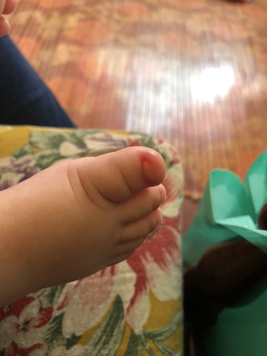 Ibu jari kaki