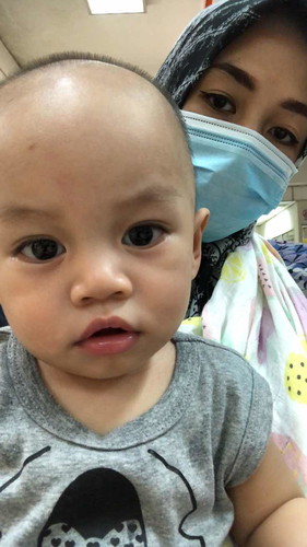 Bleeding dekat telinga (kanan) bby 9m