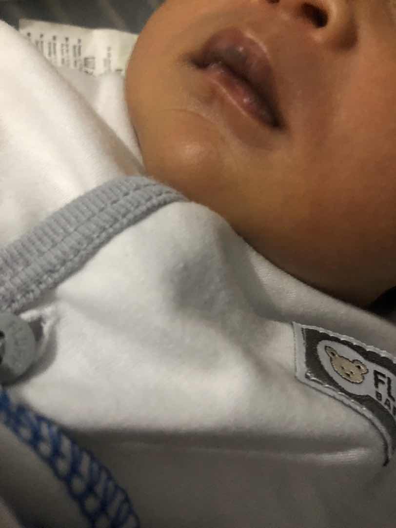 bibir bayi menghitam dan kering?