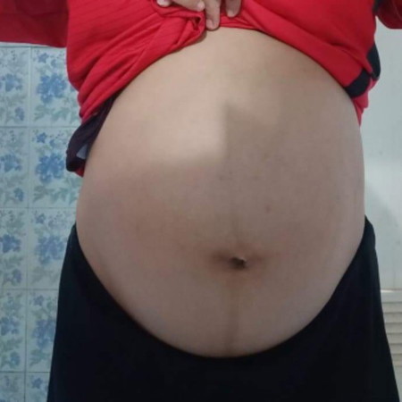 เขาดูกันยังไงว่าได้ลูกชาย หรือ หญิง ?? 39+4