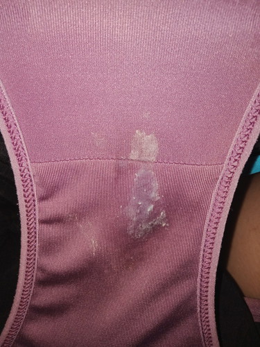 mucus plug