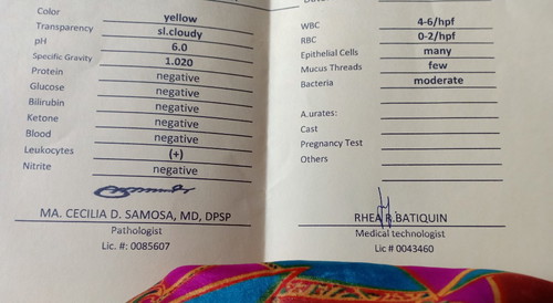 URINALYSIS RESULT