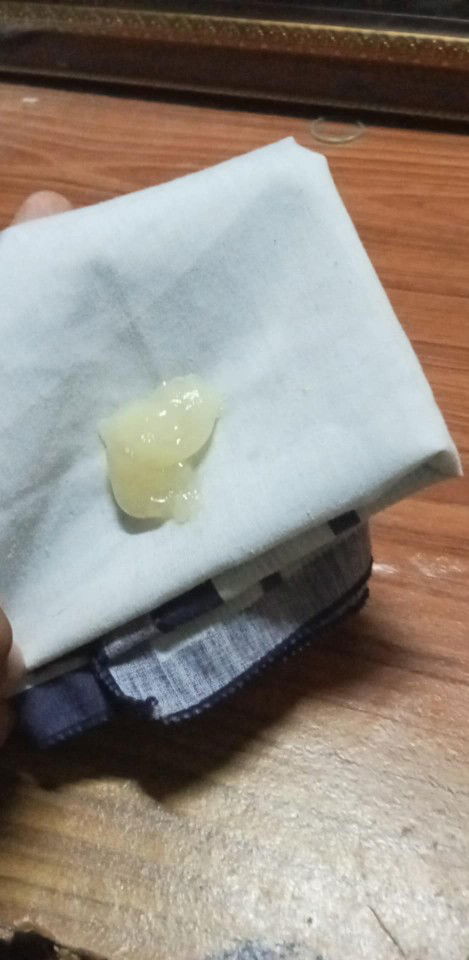 มีมูกใสออก