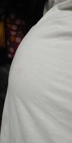 tummy