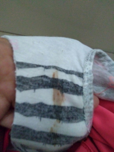 missed period and spotting