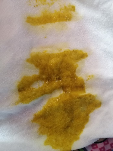 แบบนี้ท้องเสียไหมคะ