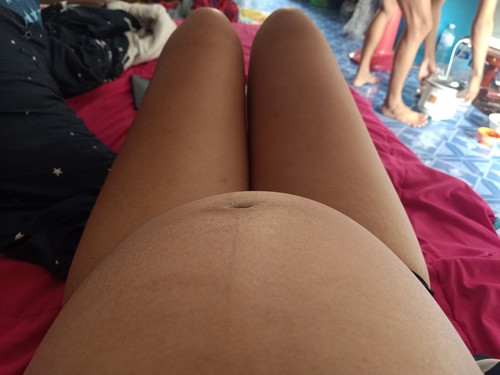 ครบกำหนด23กุมภานี้แล้ว ยังไม่มีอาการปวดเลย