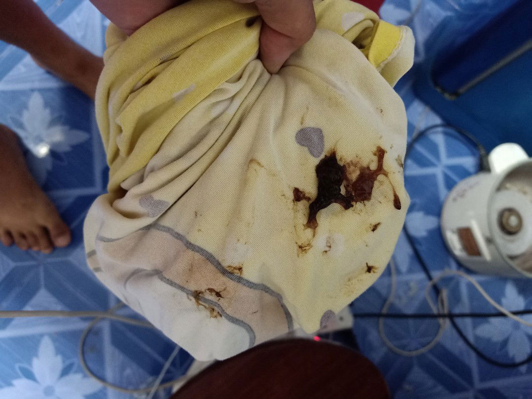 มีแบบนี้ออกมา แต่หมอให้กับบ้านดูอการ