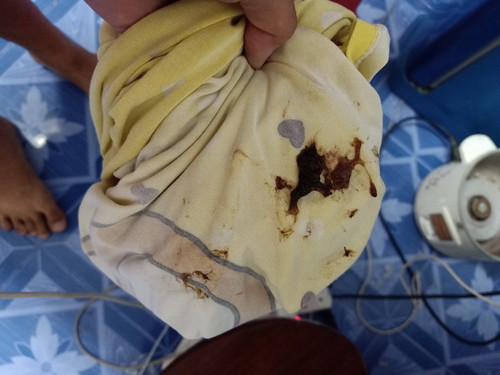 มีแบบนี้ออกมา แต่หมอให้กับบ้านดูอการ