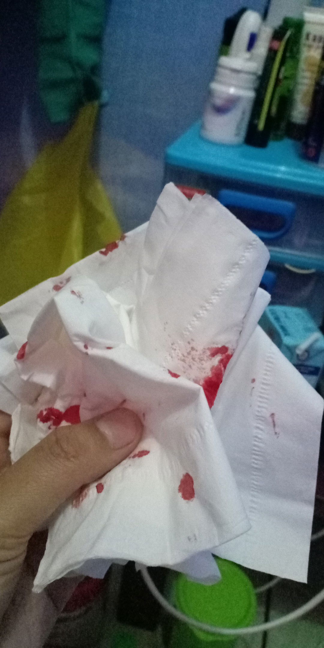 mimisan saat hamil trimester ketiga