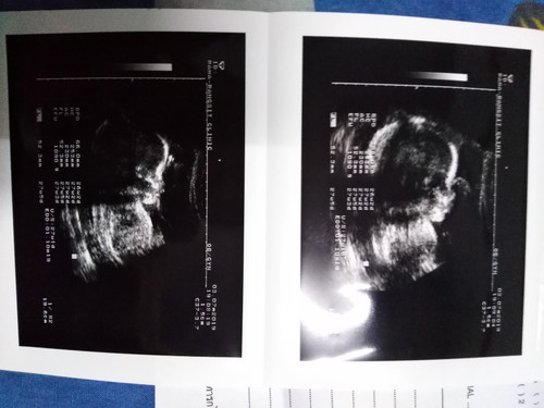 ถีบแรงขนาดนี้หนูคงอึดอัดอยากออกไช่ไหมลูกทนหน่อยอีก2เดือนกว่าเราได้เจอกันละ