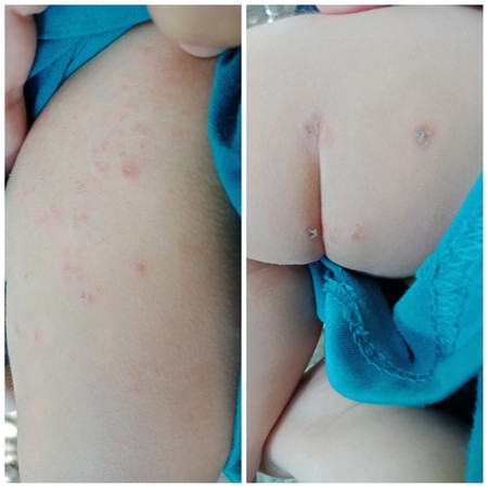 worried about my baby's skin.