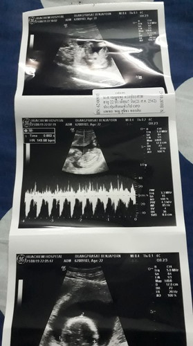 4-5เดือนท้องยังไม่ออกเลยค่ะ