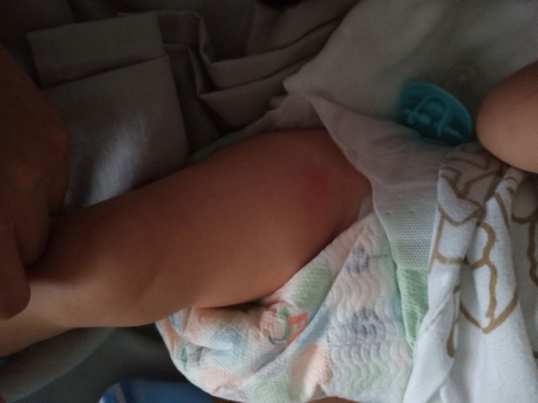 namamaga pano mawala