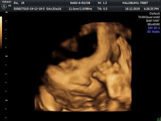 Elo Humairo profile icon