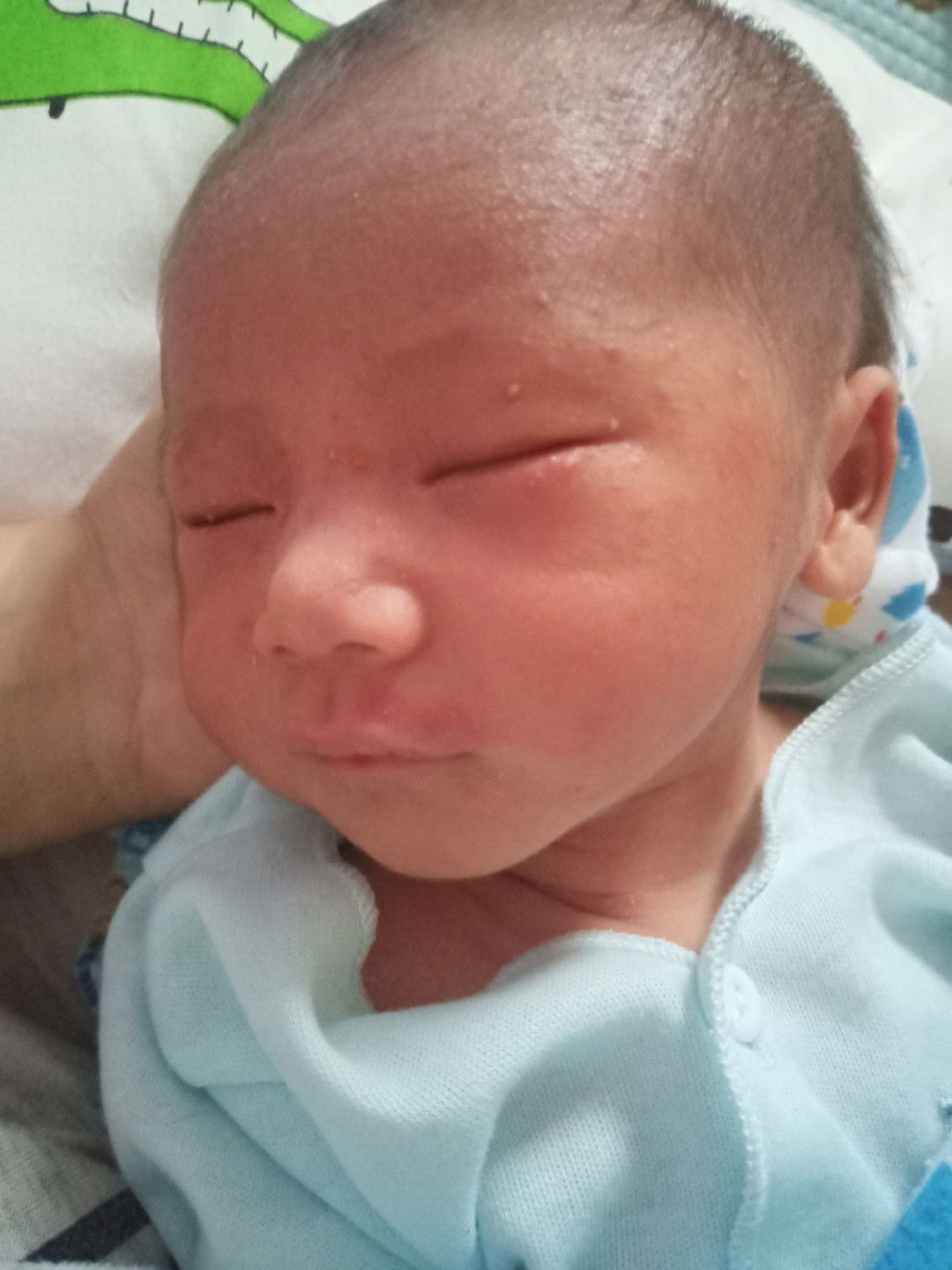 bintik2 merah kekuningan pada bayi baru lahir