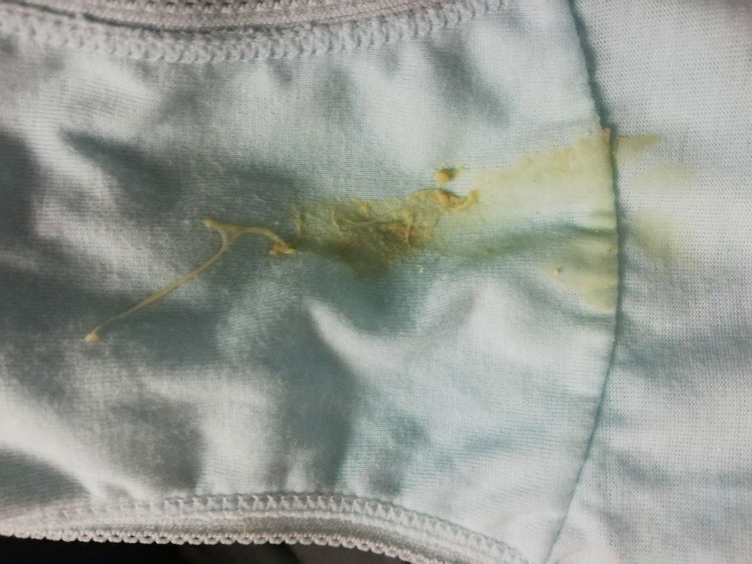 Discharge at 37 weeks.