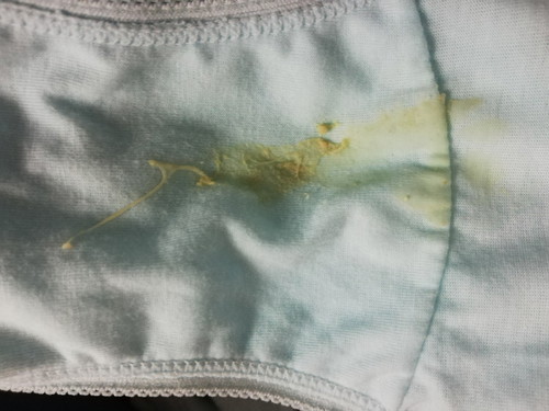 Discharge at 37 weeks.