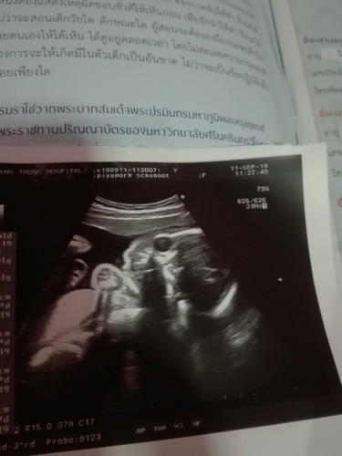 อยากรู้เพศ
