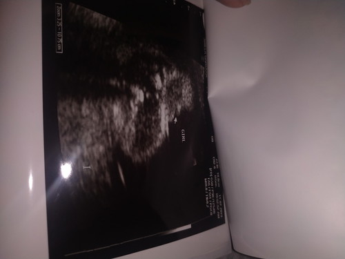 5months ultrasound