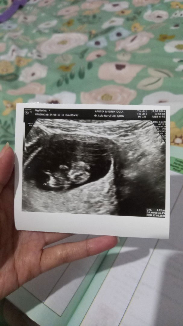 Recka PN profile icon