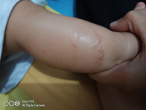 bagusnya salep apa ya?