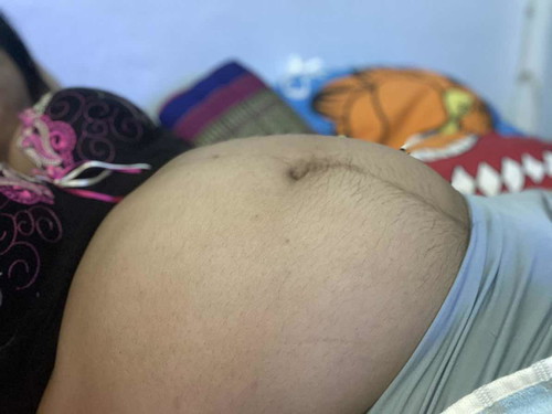 ท้องใหญ่