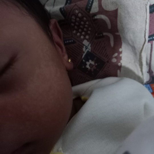 bintik putih pada bayi