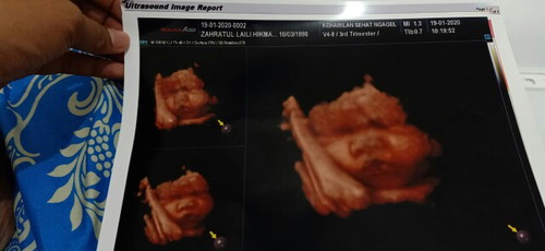 31 week 3day