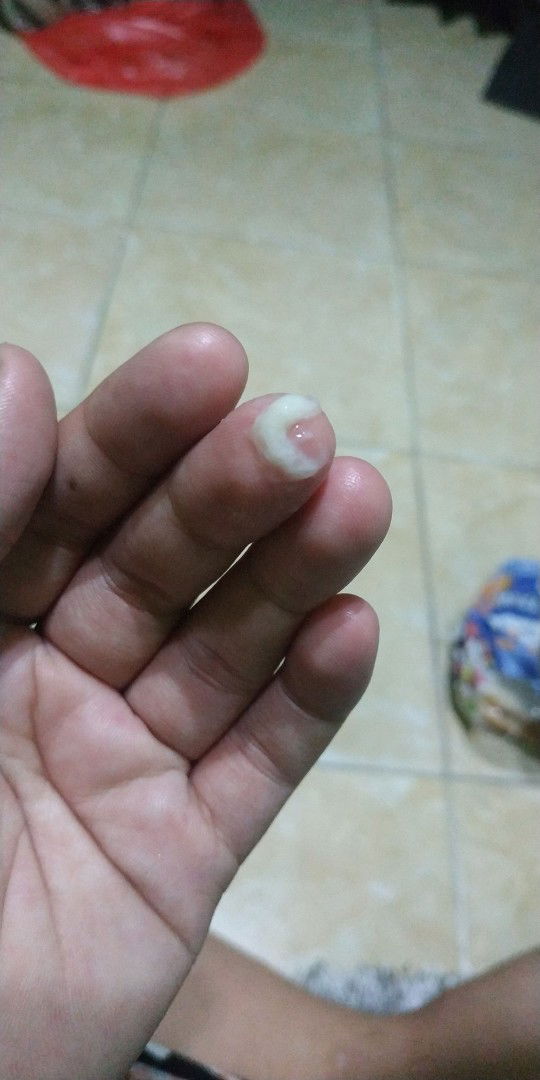 Keluar Lendir Putih Apakah Tanda Pembukaan