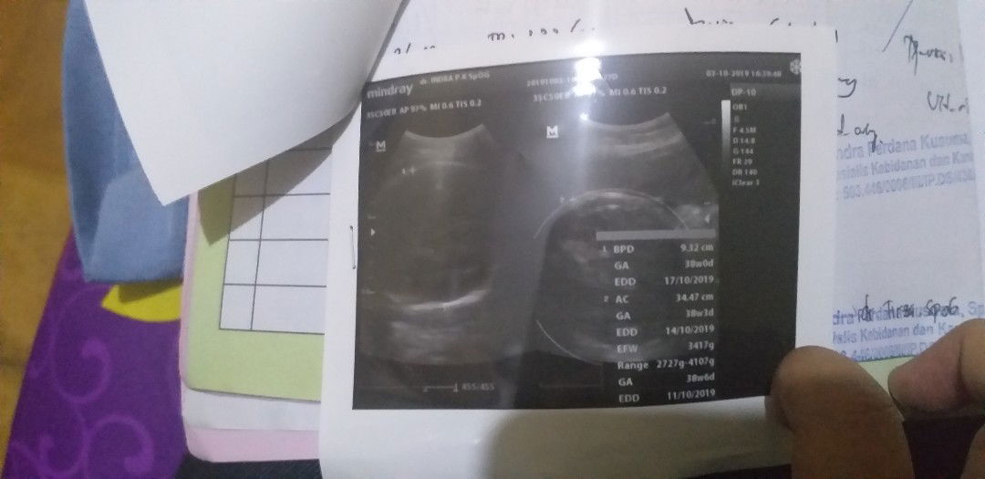 kehamilan