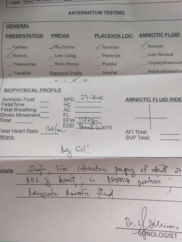normal po ba lahat?