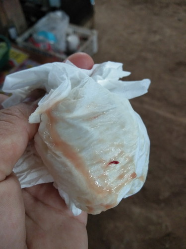 มี มูก เลือด ออก ไปโรงบาลเลยไหมคะ