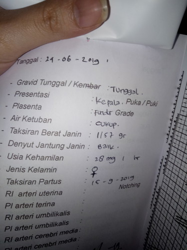 Kehamilan