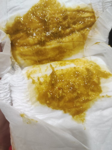 Bayi full asi umur 1 bulan bab ada sedikit darah apa yang harus saya lakukan ya bun, apa diare??