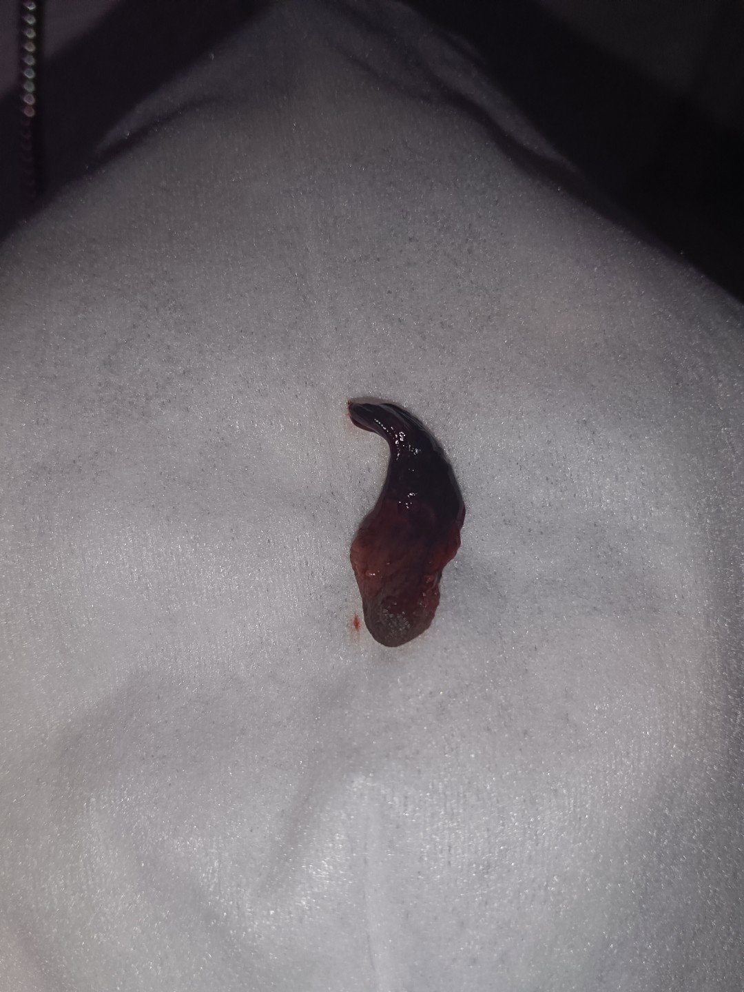 Mucus Plug