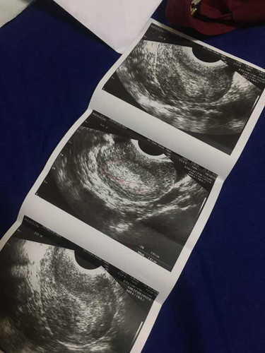 สอบถามค่ะ