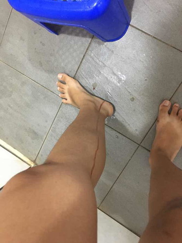 เลือดไหล