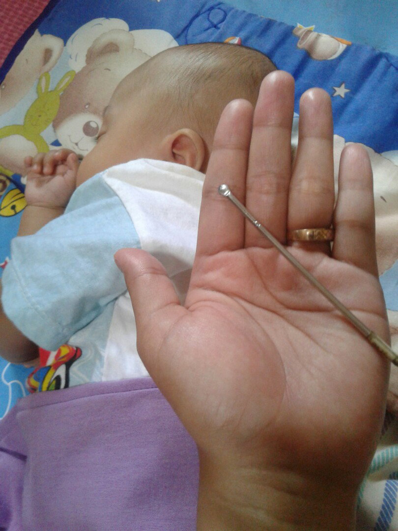 bersihin telinga bayi usia 3 bln