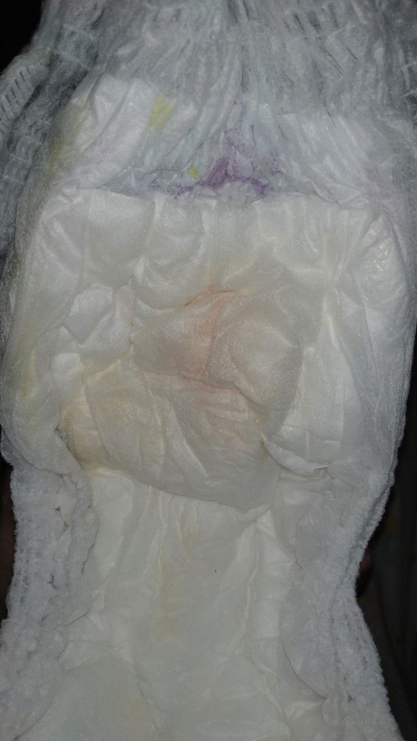 air pipis bayi kemerahan