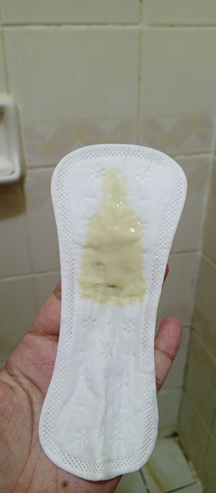 Hello pooo, is this normal po?