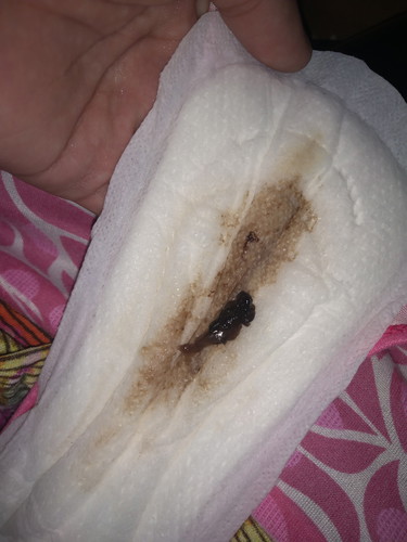 brown discharge after inserting primrose