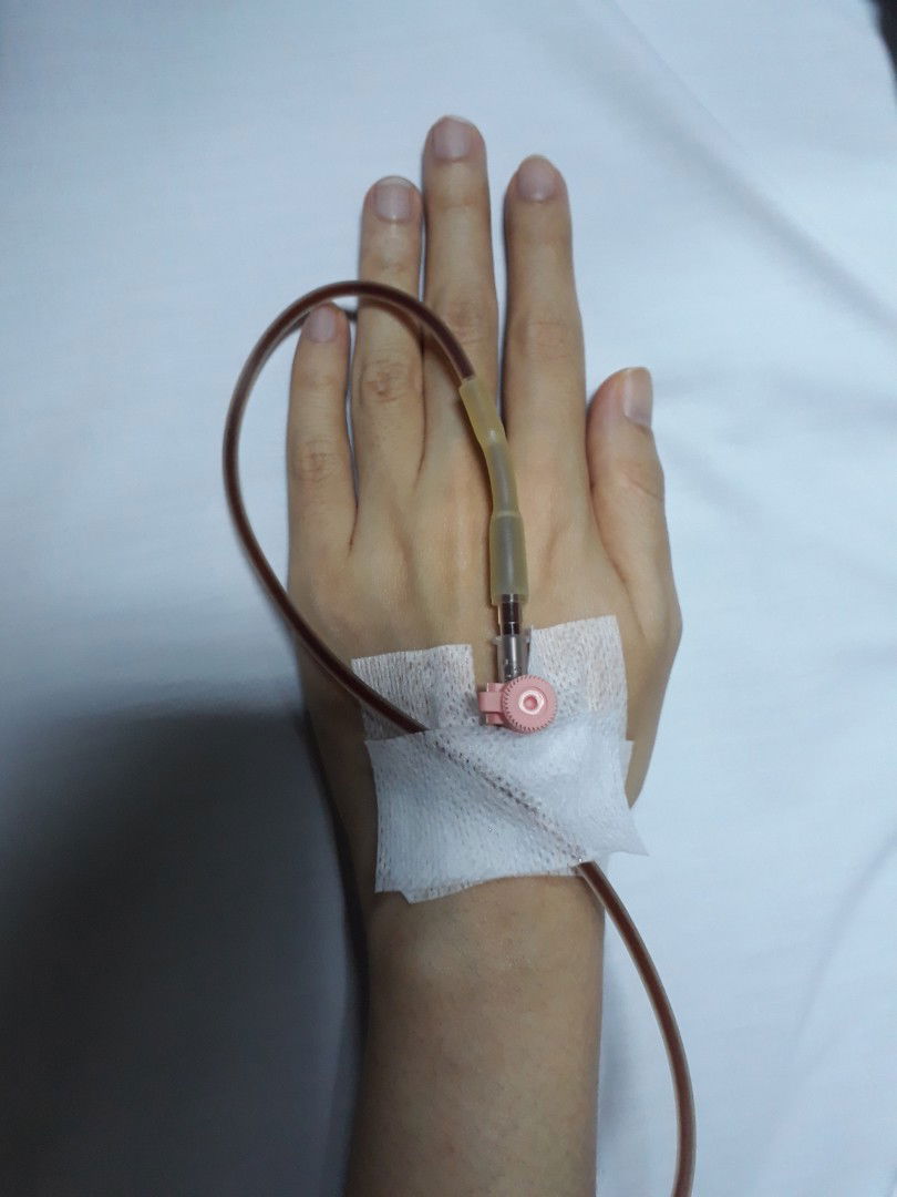 Anemia Defisiensi Zat Besi - Infus Venofer