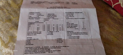 UTZ RESULT
