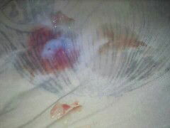 (PRESSURE) 38WEEKS AND 6DAYS