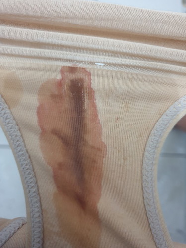 bloody show on 38 weeks