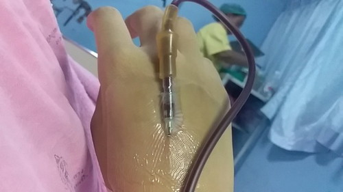 การคลอดหน้ากลัวไหม 36w + แล้วอาการเสี่ยง