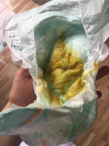 Normal lang ba poop ni baby?